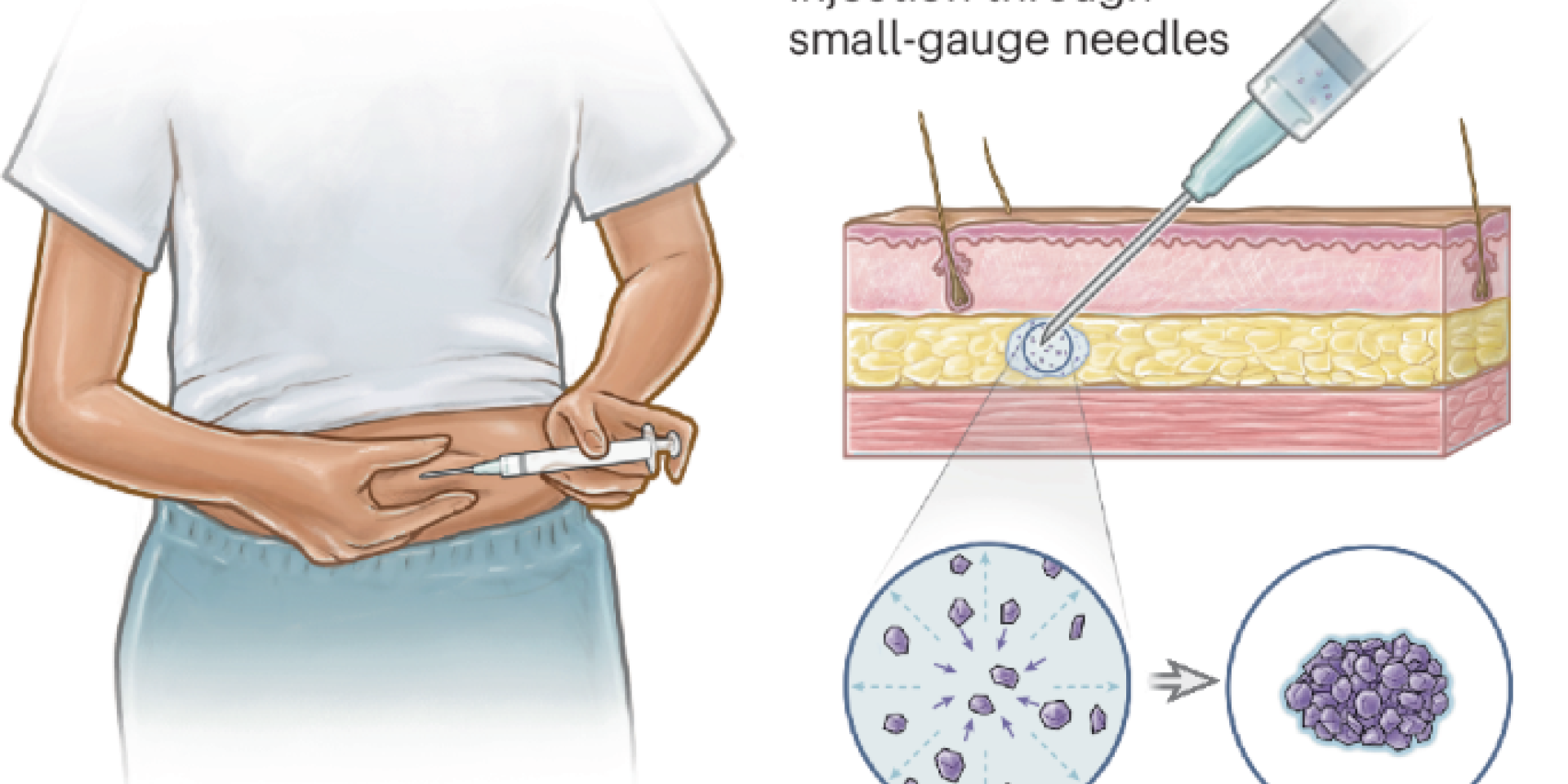 Illustration of someione injecting a drug in their stomach with a close up of the needle in bodytissue